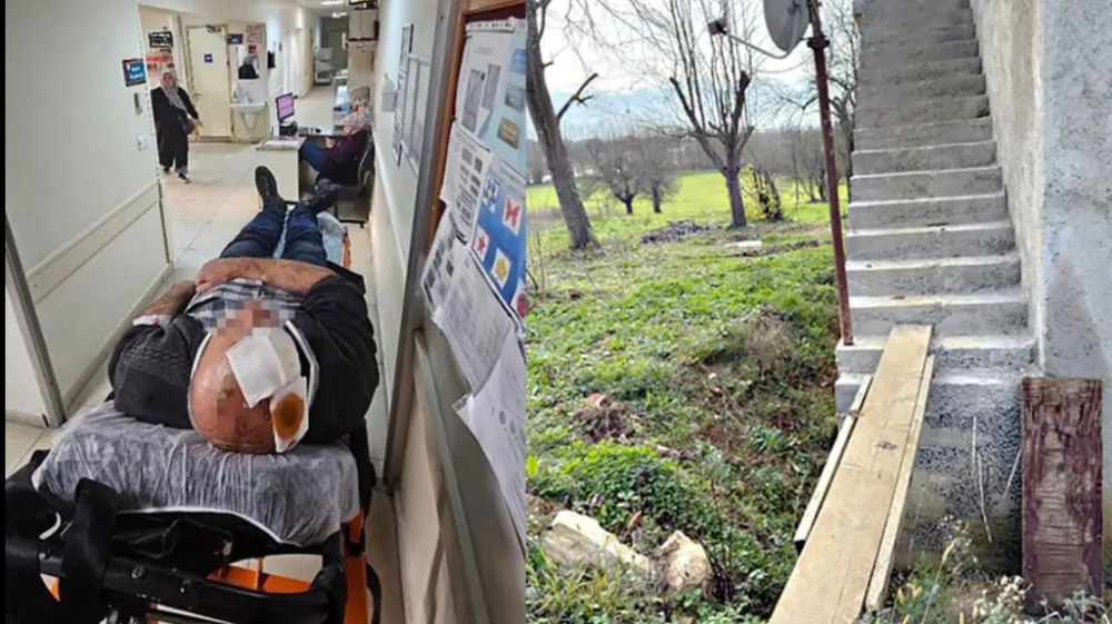 Merdivenlerden  İnerken Dengesini kaybetti  Yurvarlandı Hastaneye kaldırıldı